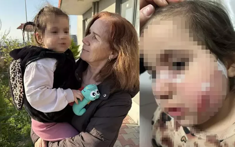 İzmir'de köpek dehşeti! 3 yaşındaki çocuğun yüzü pençe ve ısırıkla dolu 1 69a72794734bf4e1b16e8f8e