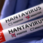 Hantavirus 4 Flrvh4
