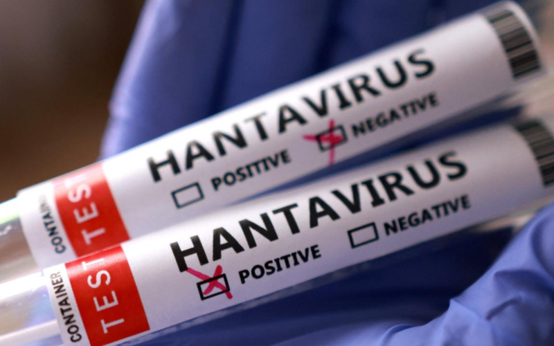 Hantavirüs şüphesinde 3 Türk vatandaşının testi açıklandı 1 Hantavirus 4 Flrvh4